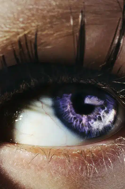 EYE-KLINKO-HILTON-CONTEMPORARY